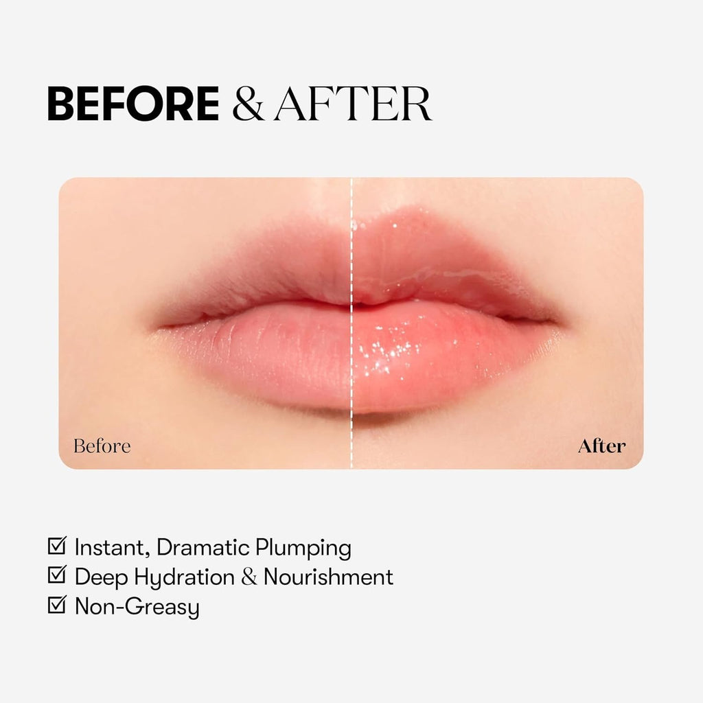 ✨ Reedle Shot Lip Plumperr - K-Beauty Tech ✨